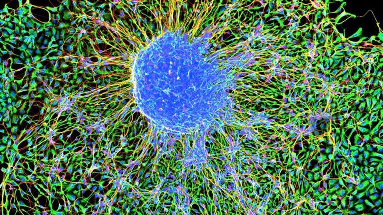 Insights into Neurogenesis and Neural Stability